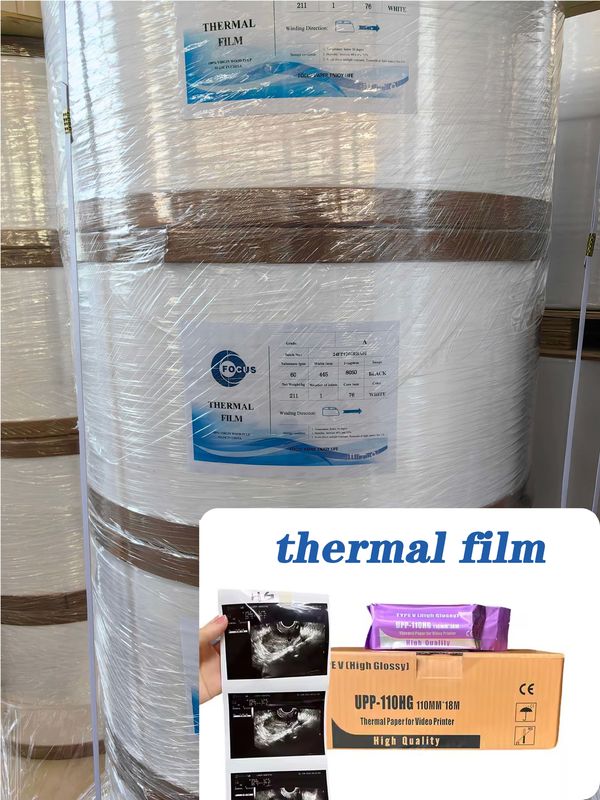 Thermal Print Film for Ultrasound Paper Eco-Friendly Recyclable Options in 75um 95um Ideal for Packaging Labels Bulk Rolls